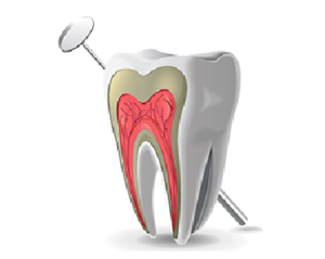 endodoncia